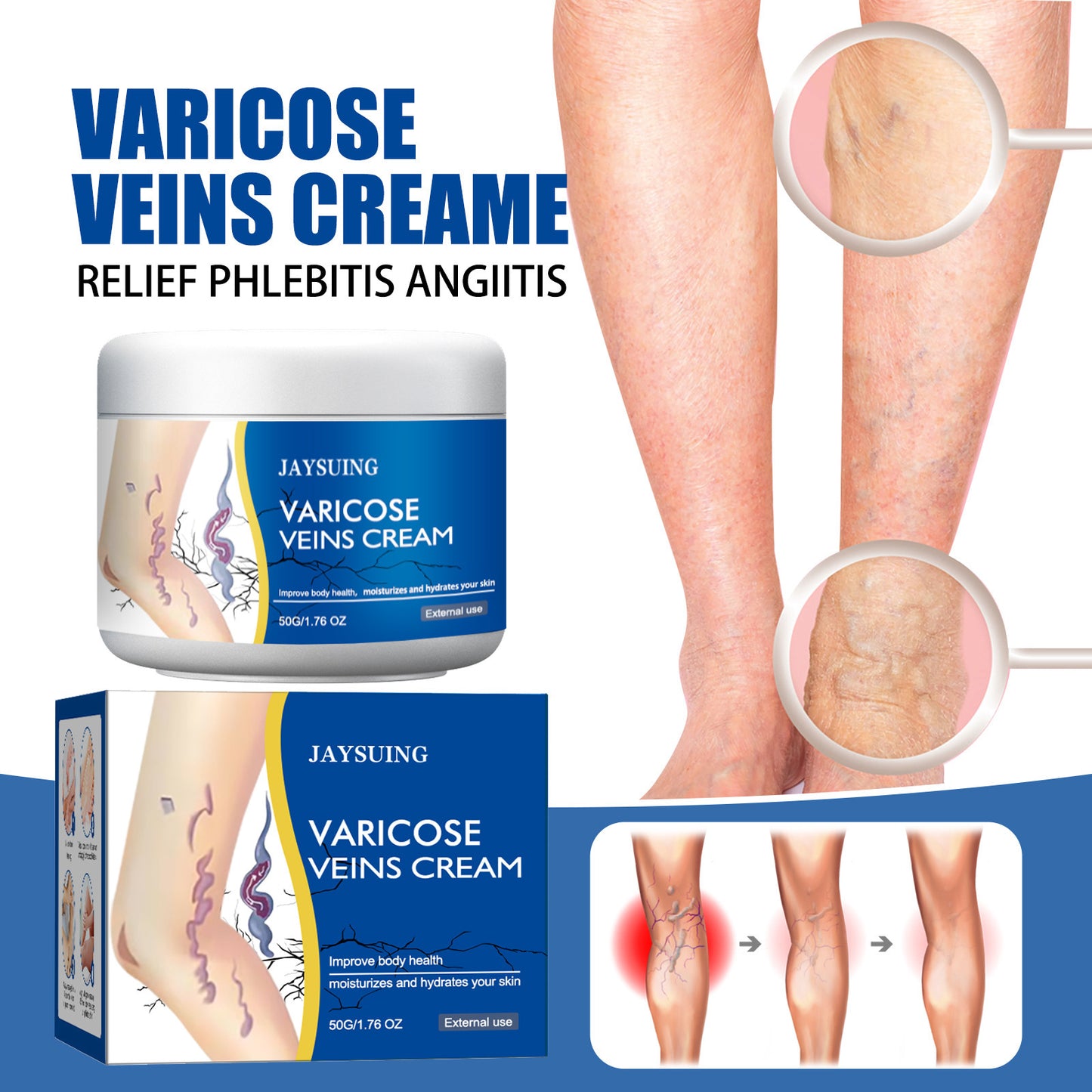 Varicose Repair Cream