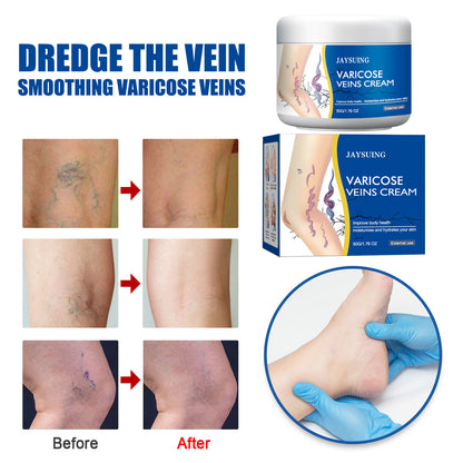 Varicose Repair Cream