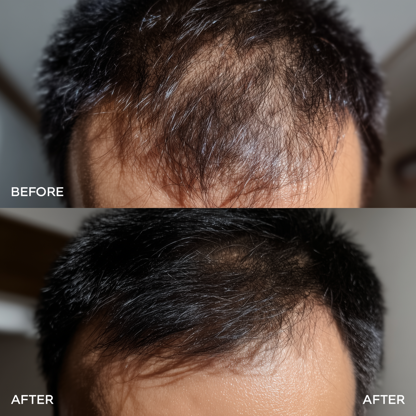 EELHOE Rosemary Hair Growth Oil - Professional Formula, Natural Results