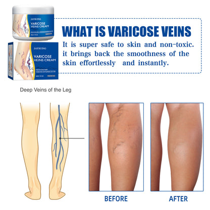 Varicose Repair Cream