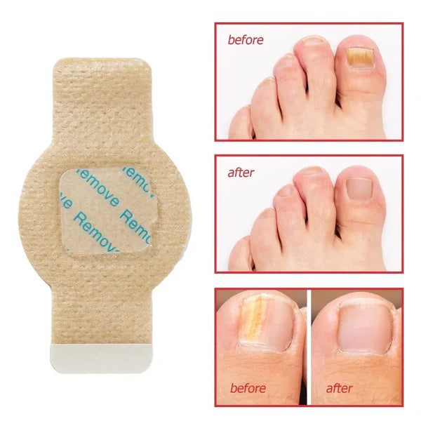 Overnight Nail Care Patch