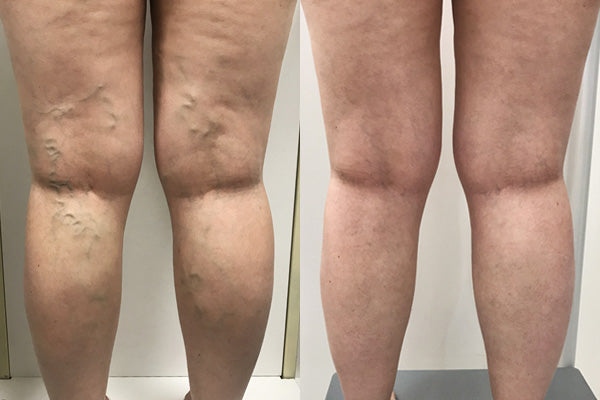 Before transformation