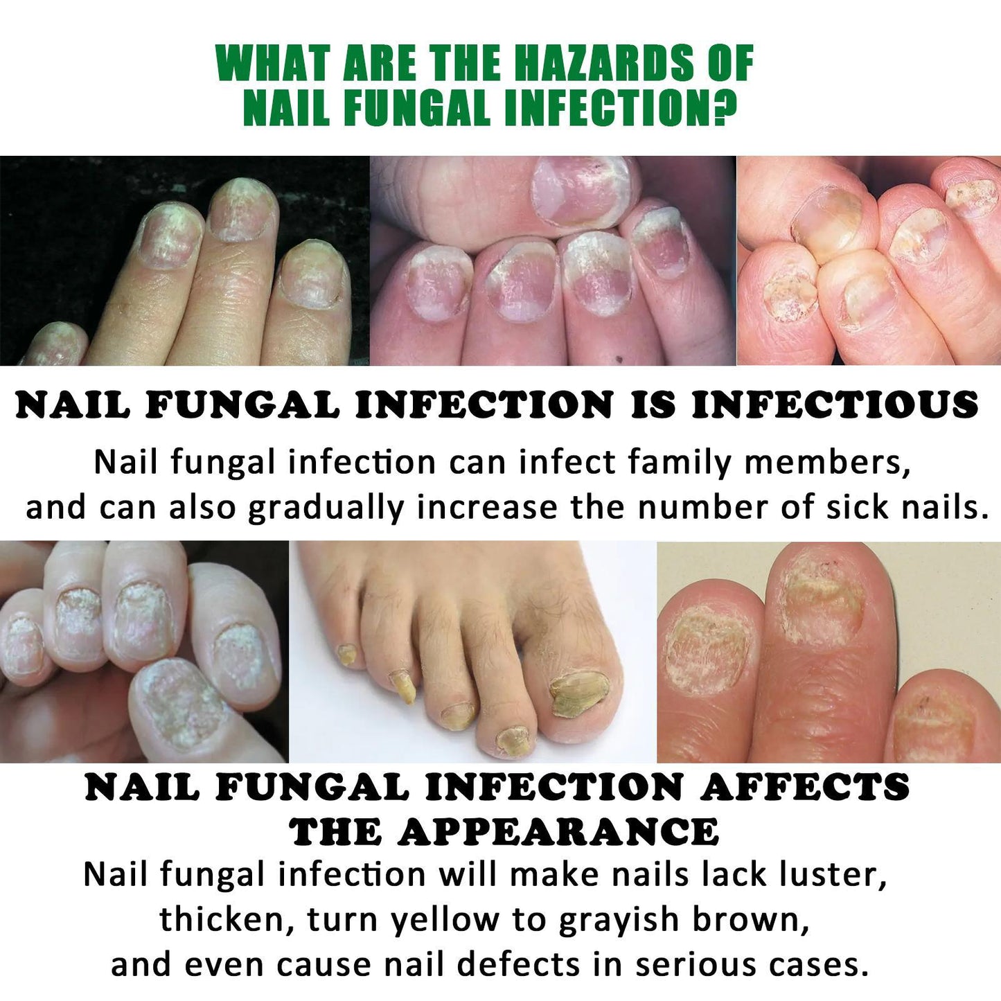 JAYSUING 7 Days Nail Fungus Treatment - All Plant Formula