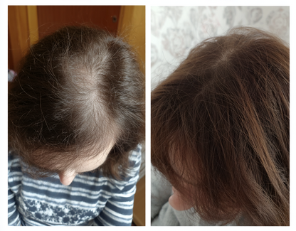 EELHOE Rosemary Hair Growth Oil - Professional Formula, Natural Results