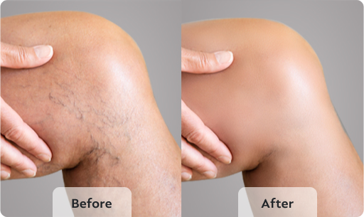 Before transformation